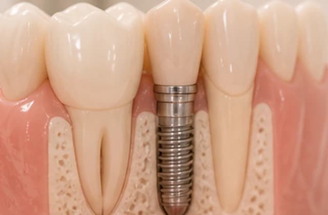 Botulinum Toxin Injection treatment visual